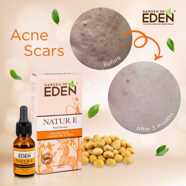 Garden Of Eden Natur E Scar Serum 15ml For Cheap